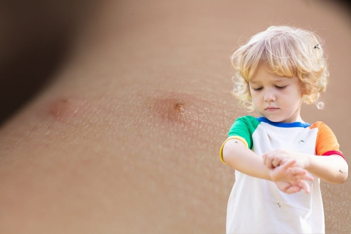 Essential Oils for Bug Bites on Toddlers